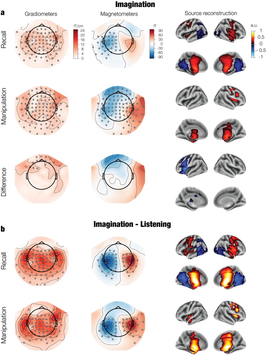 David Quiroga🧠👂🎵 🇨🇴 @dquiroga.bsky.social (@dariquima) on Twitter photo Have you ever had a song stuck in your head?
Then you might be interested in our new #musicscience work just published in <a href="/PLOSBiology/">PLOS Biology</a>
doi.org/10.1371/journa…
We used decoding to investigate how the brain represents perceived and imagined musical sounds.
TL;DR below 1/ Have you ever had a song stuck in your head?
Then you might be interested in our new #musicscience work just published in <a href="/PLOSBiology/">PLOS Biology</a>
doi.org/10.1371/journa…
We used decoding to investigate how the brain represents perceived and imagined musical sounds.
TL;DR below 1/