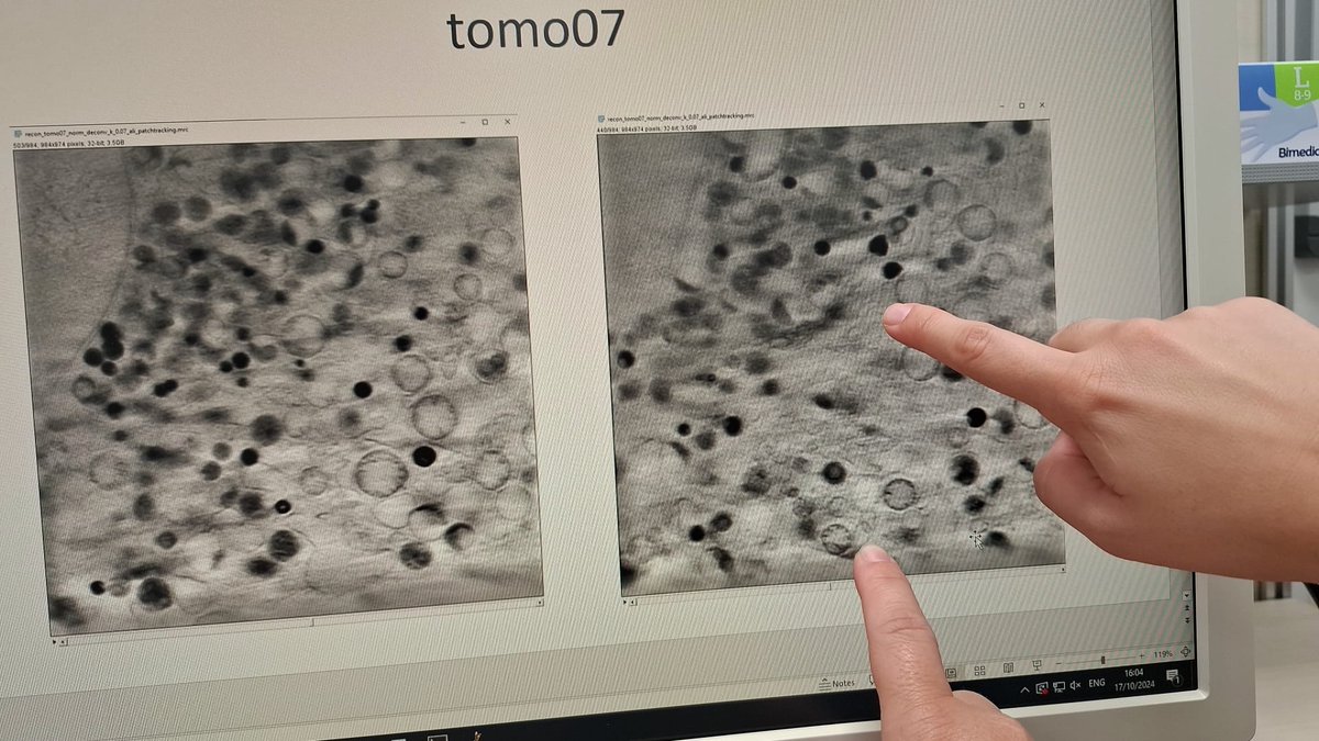 2/4 🚨 Our actual goal is to identify therapeutic targets for GDAP1-related CMT. We’re focusing on Membrane Contact Sites (MCS) and their dynamics as promising, druggable targets.
