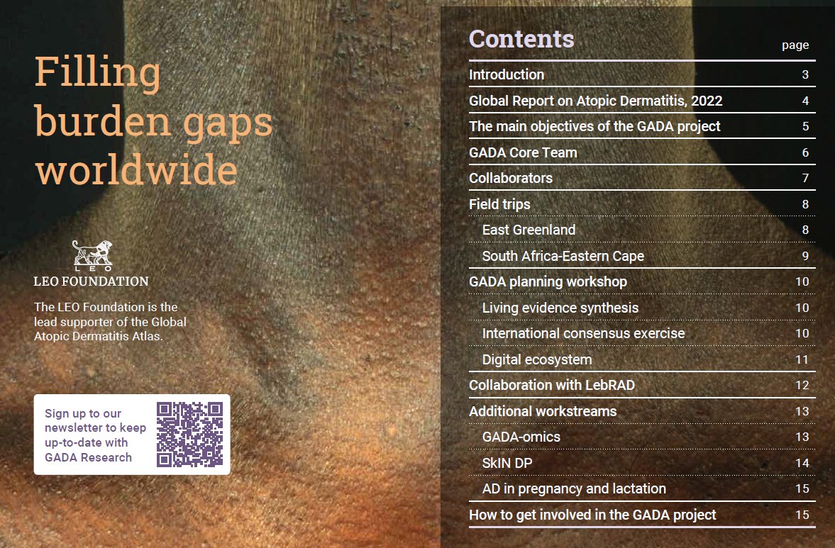 Global Atopic Dermatitis Atlas (GADA) (@globaladatlas) on Twitter photo 🚀 <a href="/globalADatlas/">Global Atopic Dermatitis Atlas (GADA)</a> is making strides in addressing gaps in the global burden map for atopic dermatitis. Check out our latest update for ongoing and upcoming work: atopicdermatitisatlas.org/en/explore-dat… 🌍
#AtopicDermatitis #SkinHealth #EczemaAwarenessMonth #GlobalHealth #Dermatology #Eczema 🚀 <a href="/globalADatlas/">Global Atopic Dermatitis Atlas (GADA)</a> is making strides in addressing gaps in the global burden map for atopic dermatitis. Check out our latest update for ongoing and upcoming work: atopicdermatitisatlas.org/en/explore-dat… 🌍
#AtopicDermatitis #SkinHealth #EczemaAwarenessMonth #GlobalHealth #Dermatology #Eczema