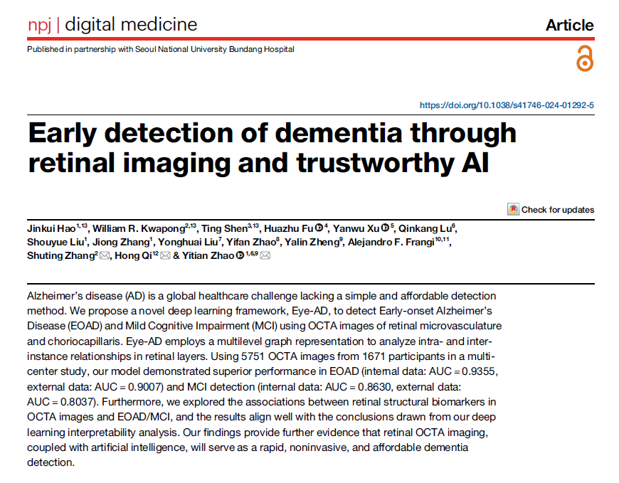 npjDigitalMed's tweet photo. A #deeplearning model that detects early Alzheimer's disease and mild cognitive impairment using retinal scans is introduced in this paper.

Eye-AD demonstrated high accuracy in identifying these conditions, showing potential as a fast, non-invasive, and affordable tool for early dementia detection using retinal biomarkers.

https://t.co/1OrMc8TQ4X