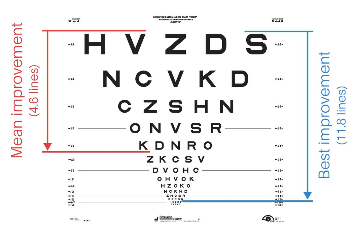 I'm super excited to share some results from the Science PRIMA retinal prosthesis clinical trial, including that it's exceeded its main efficacy endpoint with a mean acuity improvement of 4.6 EDTRS lines. Trial participants are almost completely blind due to macular degeneration.