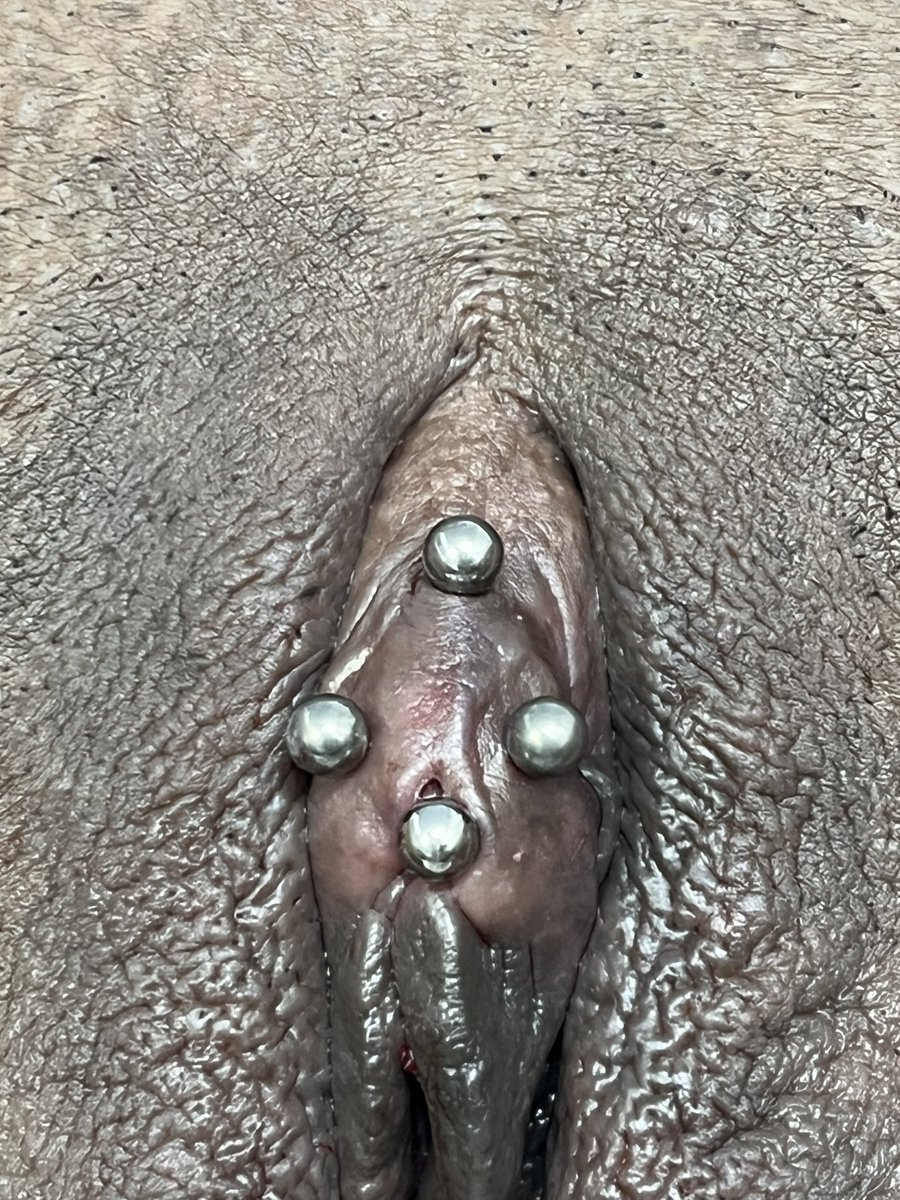 evandropiercer's tweet photo. #verticalhoodpiercing #triangulopiercing https://t.co/weWJUKwO5A