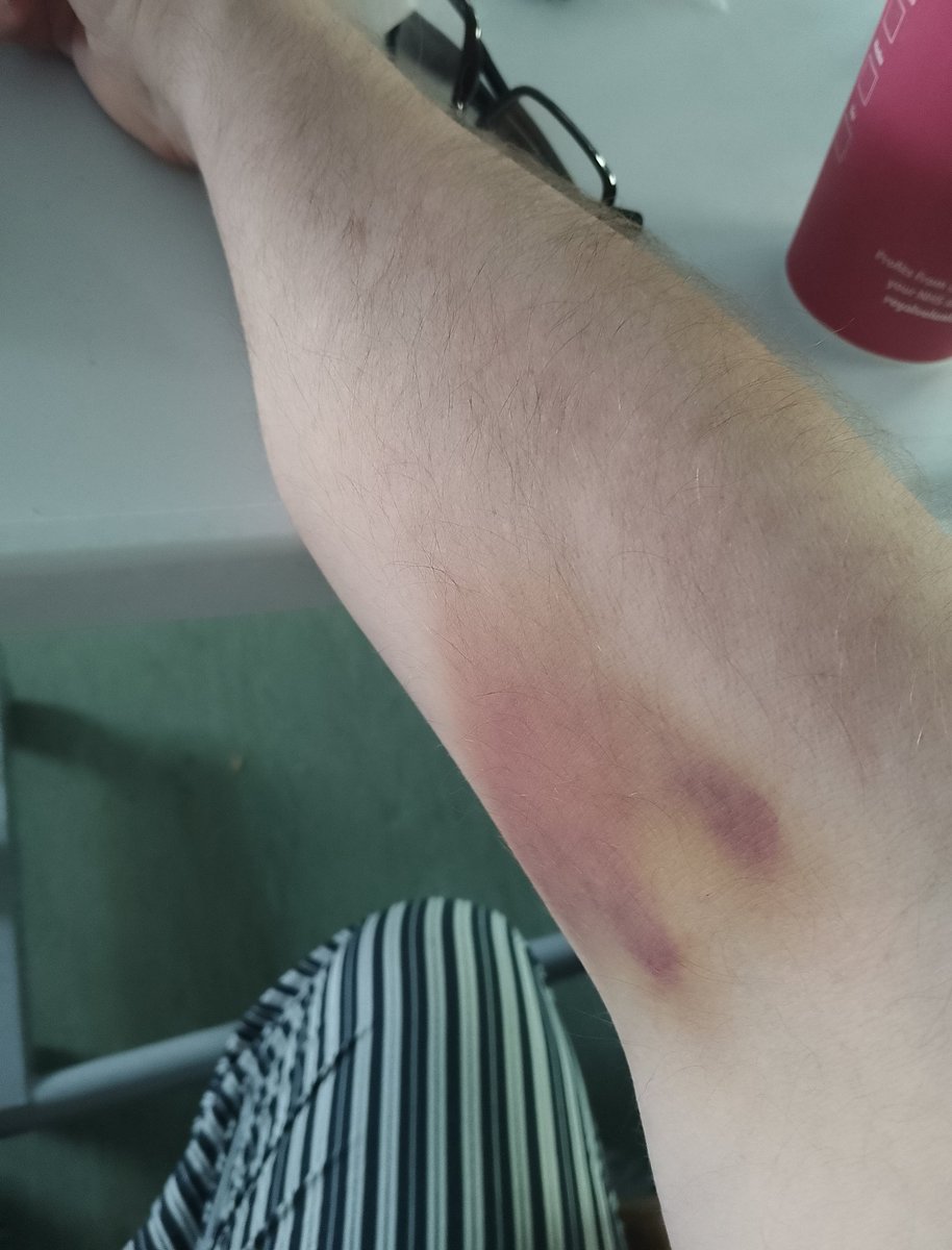 Martin Robertson tweet media