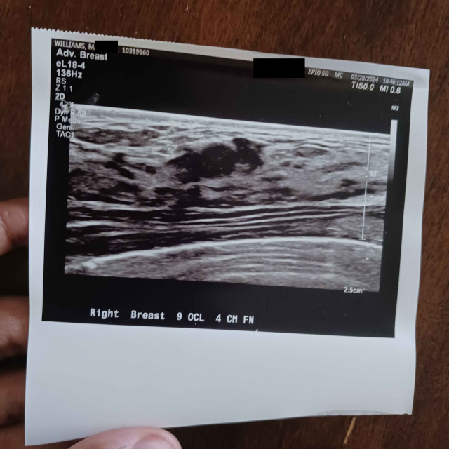 luc @ 🦋 tweet media