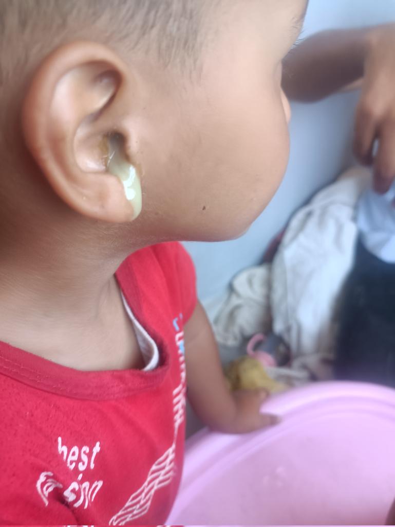 Please don't scroll🛑

  Help is urgently needed 💔
 My children has severe pain in his ear.
 ‼️This is the only thing I ask 🙏 
Donate any amount and share it with everyone who can help please 🍉gofund.me/db6b7feb
x.com/stolenmylove/s…