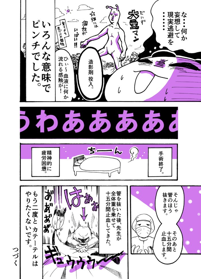 33歳漫画家志望が脳梗塞になった話(4/7)
～カテーテル編～ 