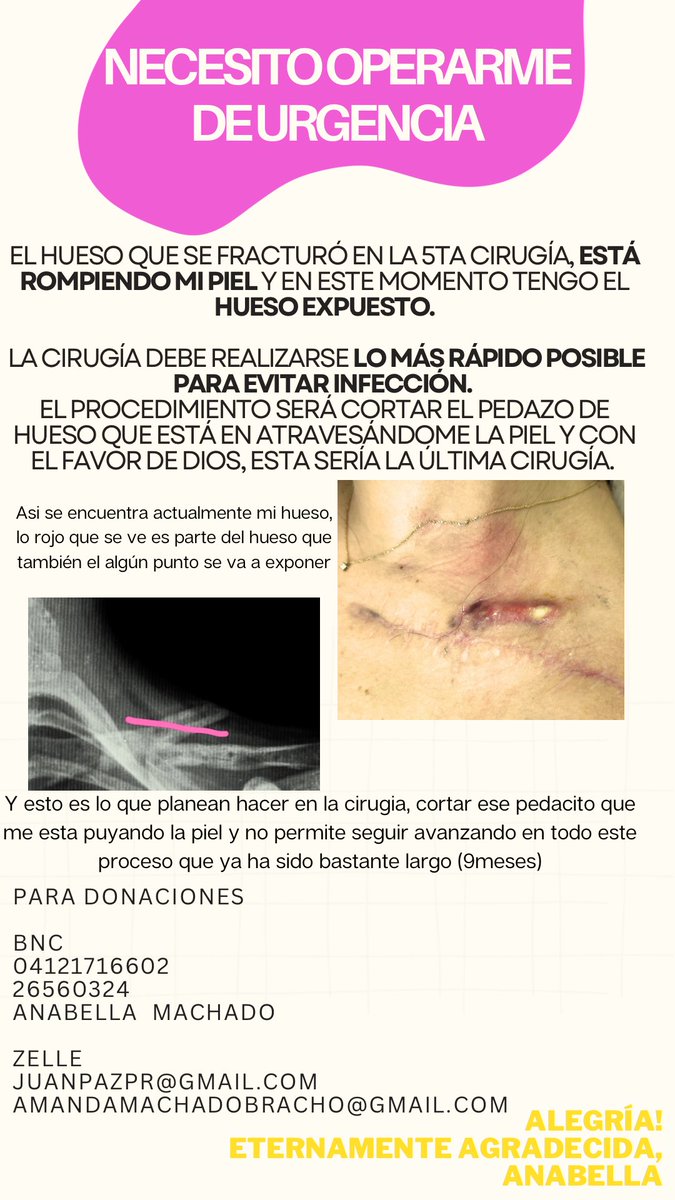 Holis 💛 estoy recaudando fondos para mi 6ta operación de clavícula. En el flyer tienen toda la info.

Les agradecería de todo corazón que puedan compartirlo