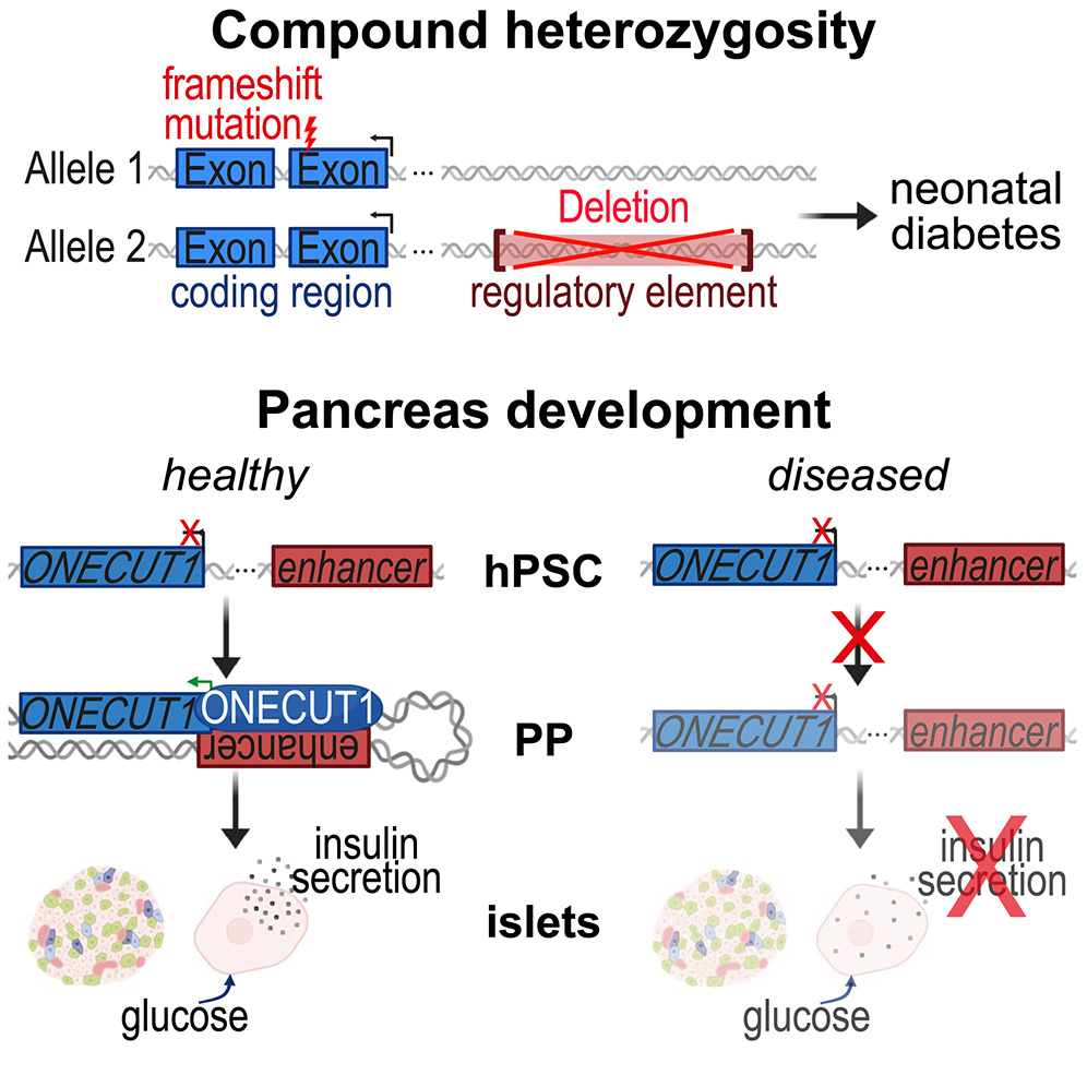 Costa Lab - @costalab.bsky.social (@vanvanka123) on Twitter photo Really nice to contribute to this study by <a href="/KlegerLab/">Kleger Lab</a> with <a href="/MinaShaigan/">Mina Shaigan - @minashaigan.bsky.social</a> showing that a composite mutation (gene truncation in one locus and a enhancer deletion in the other locus) of the transcription factor Onecut1 causes early onset diabetes. cell.com/cell-reports/f… Really nice to contribute to this study by <a href="/KlegerLab/">Kleger Lab</a> with <a href="/MinaShaigan/">Mina Shaigan - @minashaigan.bsky.social</a> showing that a composite mutation (gene truncation in one locus and a enhancer deletion in the other locus) of the transcription factor Onecut1 causes early onset diabetes. cell.com/cell-reports/f…