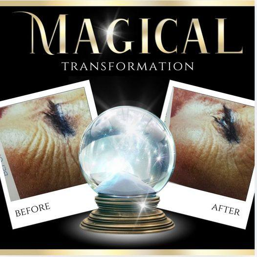 Check out our Halloween special offers!!
If you would like more information, or would like to book in to our clinic in Warrington please call us on 01925 418564
skindeepaesthetics.co.uk