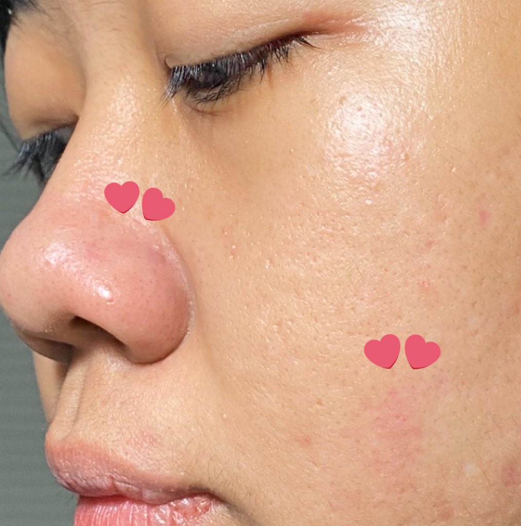 metta ♡ tweet media