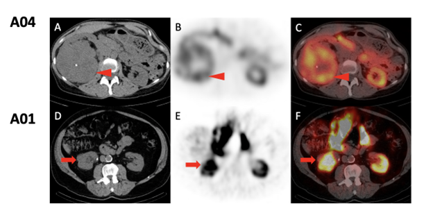 BJU International tweet media