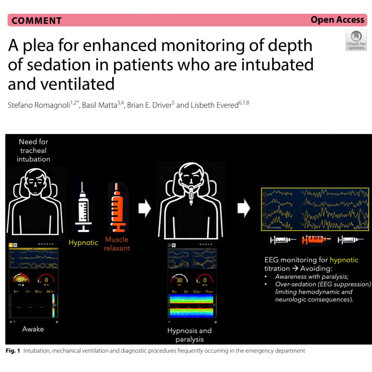 When providing paralytics for intubation or ARDS management, we often wonder if the patient is awake underneath. 12.3% of patients may recover consciousness with paralytics on board. Let’s try to fix that. 🎩 tip to the authors. 

eddyjoemd.com/foamed/