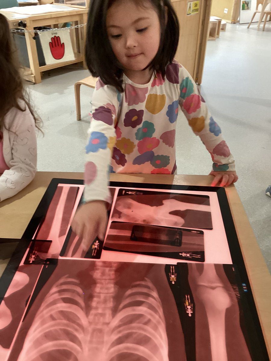This week our young learners have been learning about the human body. They’ve been looking at X-Rays and tried to name as many body parts as they can! 🩻