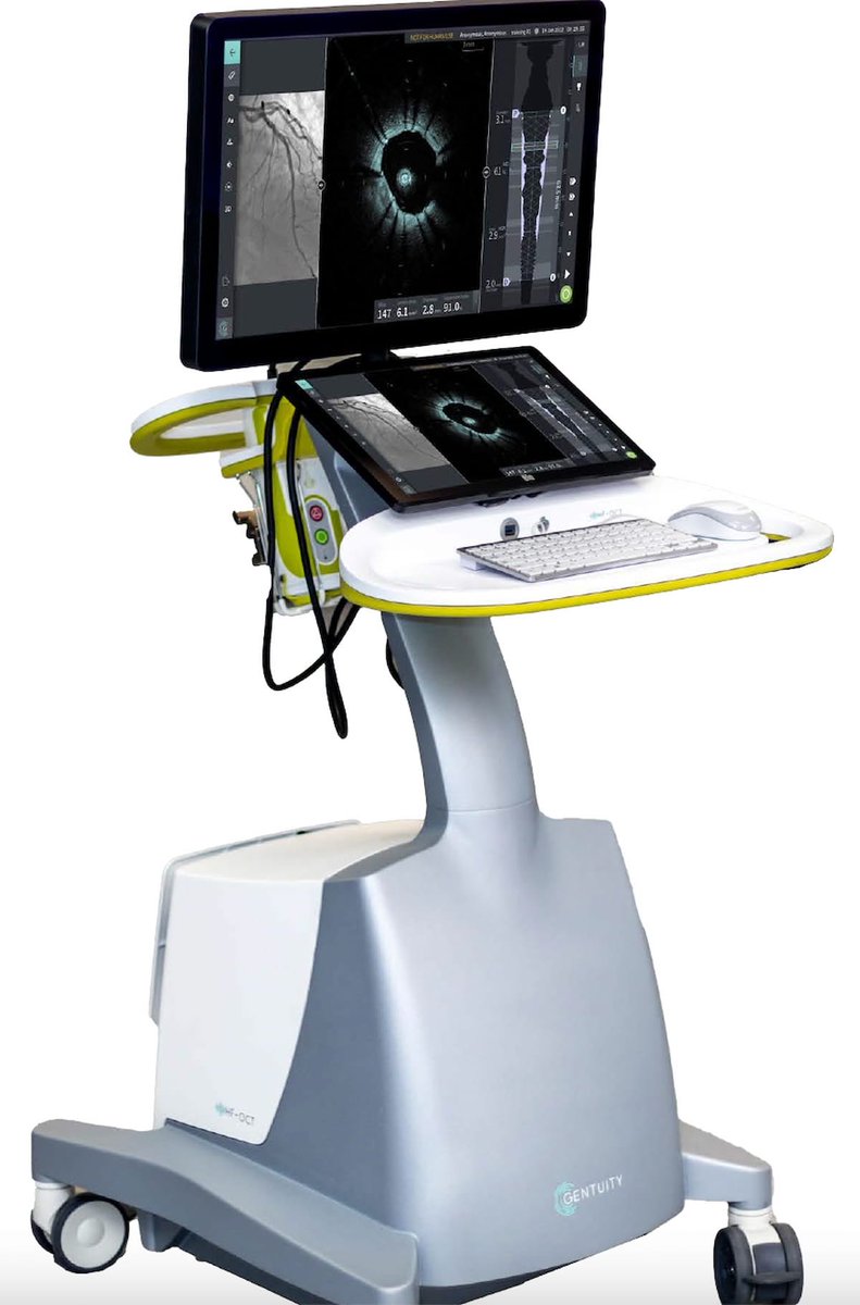 Diagnostic Imaging (@dx_imaging) on Twitter photo FDA Grants Expanded Clearance of Intravascular Imaging System for Use with Percutaneous Coronary Interventions
diagnosticimaging.com/view/fda-expan…
<a href="/ACRRFS/">ACR RFS - We've Moved! Follow <a href="/RadiologyACR/">American College of Radiology</a>.</a> <a href="/ACRYPS/">ACR YPS- We've Moved! Follow @RadiologyACR.</a> @RadiologyACR <a href="/ARRS_Radiology/">ARRS</a> <a href="/RSNA/">RSNA</a> <a href="/PennRadiology/">Penn Radiology</a> <a href="/NYUImaging/">NYU Langone Health Department of Radiology</a> <a href="/uab_ir/">UAB IR</a> @EmoryRadiology <a href="/OchsnerRads/">Ochsner Radiology</a> <a href="/gentuity/">Gentuity</a>
#radiology #RadRes FDA Grants Expanded Clearance of Intravascular Imaging System for Use with Percutaneous Coronary Interventions
diagnosticimaging.com/view/fda-expan…
<a href="/ACRRFS/">ACR RFS - We've Moved! Follow <a href="/RadiologyACR/">American College of Radiology</a>.</a> <a href="/ACRYPS/">ACR YPS- We've Moved! Follow @RadiologyACR.</a> @RadiologyACR <a href="/ARRS_Radiology/">ARRS</a> <a href="/RSNA/">RSNA</a> <a href="/PennRadiology/">Penn Radiology</a> <a href="/NYUImaging/">NYU Langone Health Department of Radiology</a> <a href="/uab_ir/">UAB IR</a> @EmoryRadiology <a href="/OchsnerRads/">Ochsner Radiology</a> <a href="/gentuity/">Gentuity</a>
#radiology #RadRes