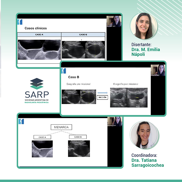 sarpargentina's tweet image. Ayer se llevó a cabo el 2do Ateneo de Residentes organizado por la SARP. Gracias a la Dra Nápoli por su disertación, a la Dra Sarragoicochea por la coordinación y a los asistentes por ser parte de este gran encuentro

Pronto lo subiremos a la sección "Zona Socios" de nuestra web
