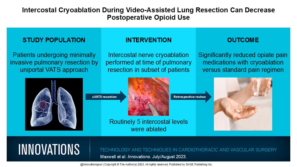 Innovations Journal (@innovationsjour) on Twitter photo Intercostal Cryoablation During Video-Assisted Lung Resection Can Decrease Postoperative Opioid Use (Maxwell et al., Jul/Aug 2023)
Read free for 90 days: journals.sagepub.com/share/QGUWDJ28…
<a href="/CMaxwellDO/">Conor Maxwell</a> <a href="/AHNtoday/">AHN</a> <a href="/AHNSurgeryInst/">AHN Surgery Institute</a> Intercostal Cryoablation During Video-Assisted Lung Resection Can Decrease Postoperative Opioid Use (Maxwell et al., Jul/Aug 2023)
Read free for 90 days: journals.sagepub.com/share/QGUWDJ28…
<a href="/CMaxwellDO/">Conor Maxwell</a> <a href="/AHNtoday/">AHN</a> <a href="/AHNSurgeryInst/">AHN Surgery Institute</a>