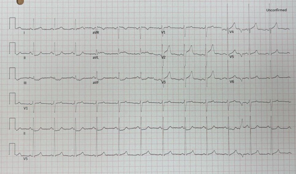 ECGs tweet media