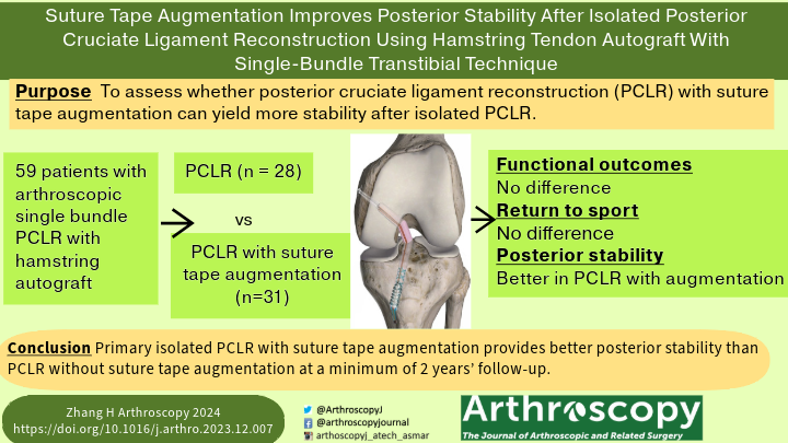 ArthroscopyJ's tweet photo. Suture Tape Augmentation Improves Posterior Stability After Isolated Posterior Cruciate Ligament Reconstruction Using Hamstring Tendon Autograft With Single-Bundle Transtibial Technique
#PCLReconstruction #SportsMedicine #SutureTape
https://t.co/GYuevySZ5C https://t.co/Ovxznk3lPg