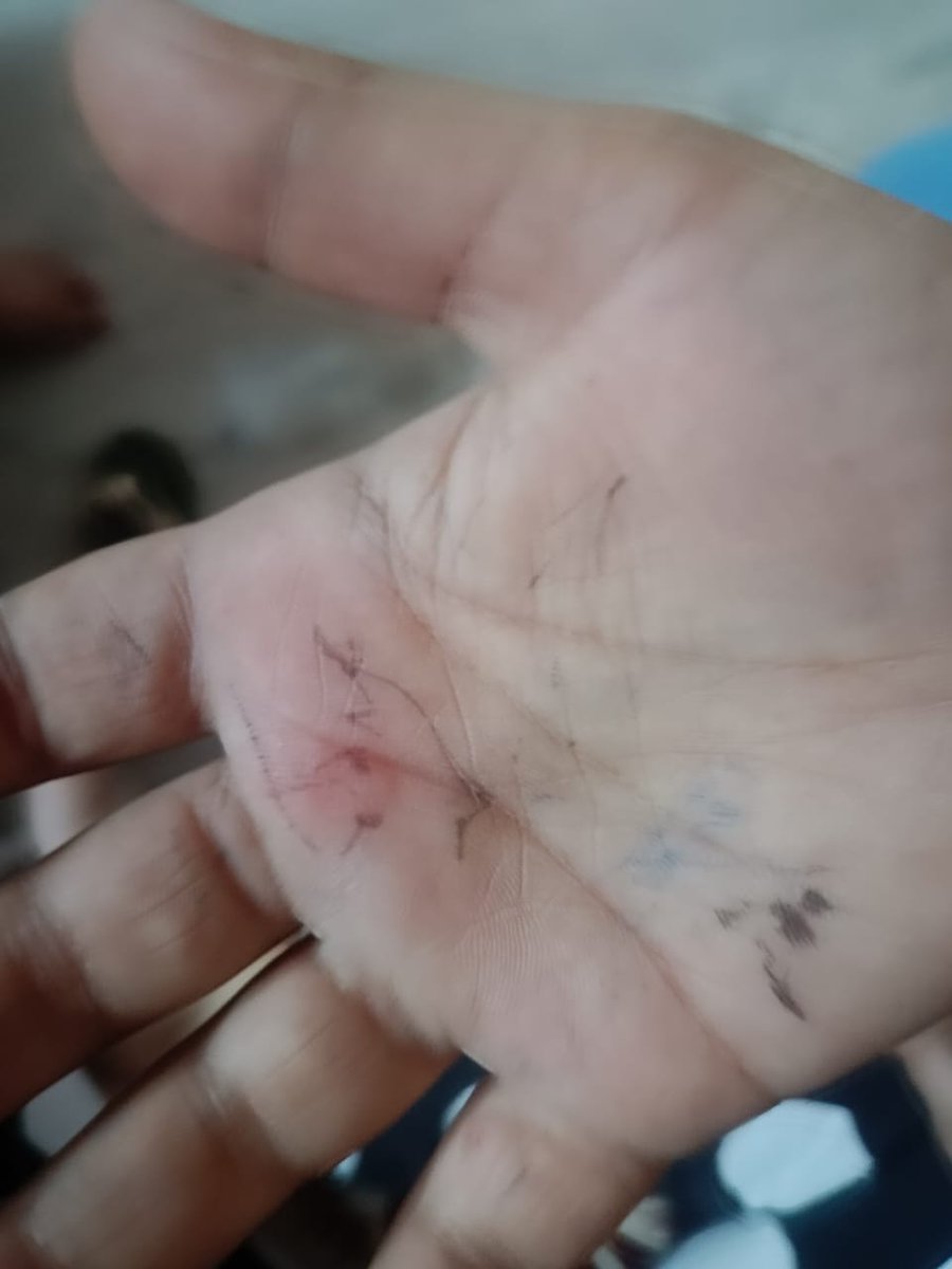 Ansshu J Anthony tweet media