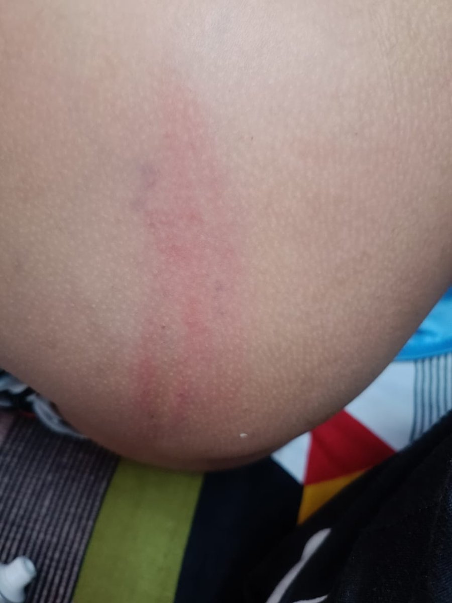 Ansshu J Anthony tweet media