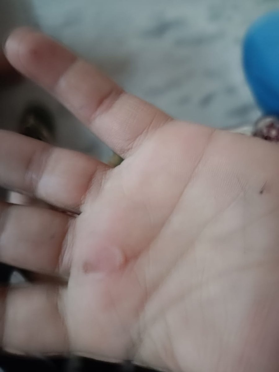 Ansshu J Anthony tweet media