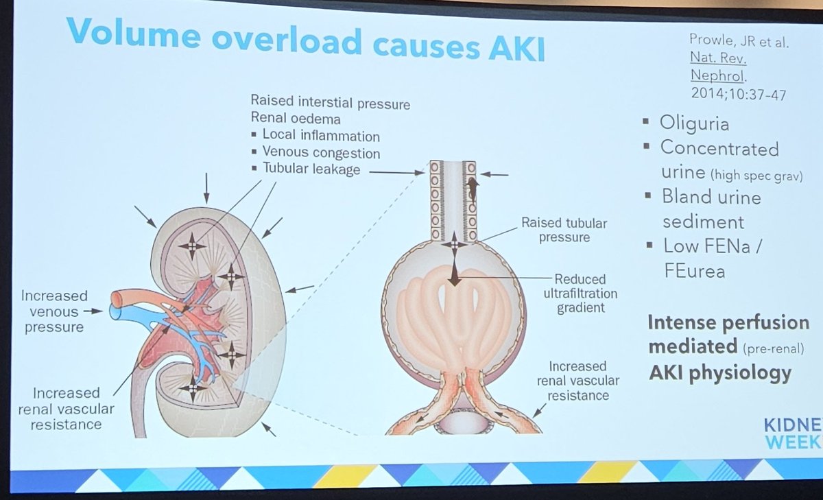 lluncornefro's tweet photo. Manejo de Fluidos💧 en px críticos Dr Michael Connor
✔️Sobrecarga de volumen produce LRA⛑️‼️
✔️Monitoreo hemodinámico es necesario⏩️ Utilidad del #POCUS🩺🎥
✔️Diuréticos 💊 no son nefrotoxicos🚫, la sobrecarga volumen sí ⛑️‼️
#KidneyWk #PreCourse #CriticalCareNephrology https://t.co/RnN5T7vgEm