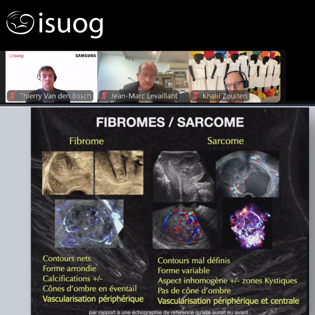ISUOG's tweet photo. Our #ISUOGEducation webinar in French was a huge success! Fantastic presentations and discussions between Prof. Thierry Van den Bosch, Dr Jean-Marc Levaillant, Dr Celine Bafort, Dr Khalil Zouiten, & Dr Thibaud Vernet. You can catch the webinar on-demand for two months: https://t.co/WpjqNXKWO2 #LoveUltrasound