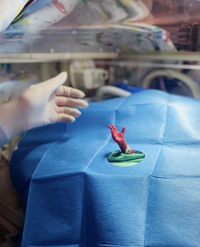 annamlulis's tweet image. A preterm baby's hand reaching for life.

She was born at 24 weeks.

Most babies at that age are called “just a clump of cells” and aborted.

She may be underdeveloped, but she is equally human and worthy of life.

A child’s age doesn’t determine their humanity.