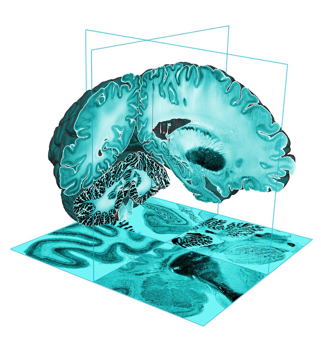 Healthy Brains, Healthy Lives tweet media