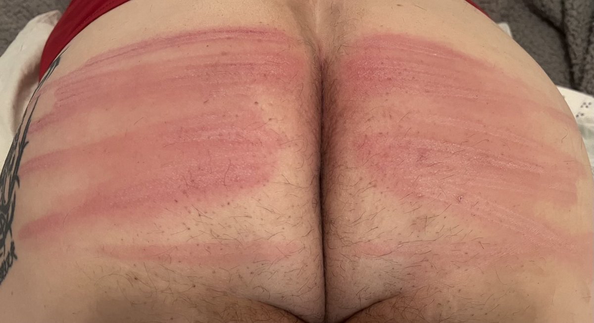 BigChasteT's tweet photo. Sometimes you get beaten just to make your owner feel better. Three times this week @ChiliMistress has used this rear for her pleasure with a maintenance beating. Today she used the delrin cane. https://t.co/Qpz3KWiJZR