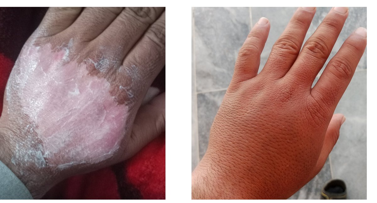 یہ جیل تشدد کا ایک ہی نظارہ ہے۔
اسے کسی نے نہیں دیکھا....لیکن ہر ایک کہتا ہے کہ ٹرینڈ میں شامل ہوں۔اس تشدّد کا جواب کون دے گا؟ ہم بس مار  کھانے کے لیے ہے۔
<a href="/iPiansRTs/">Team iPians ⁱᴾⁱᵃⁿ</a>
<a href="/kmc86012/">𝐊𝐚𝐬𝐡𝐢𝐟 𝐚𝐥𝐢 ⁱᴾⁱᵃⁿ</a>
#ضروری_صرف_خان_کی_رہائی