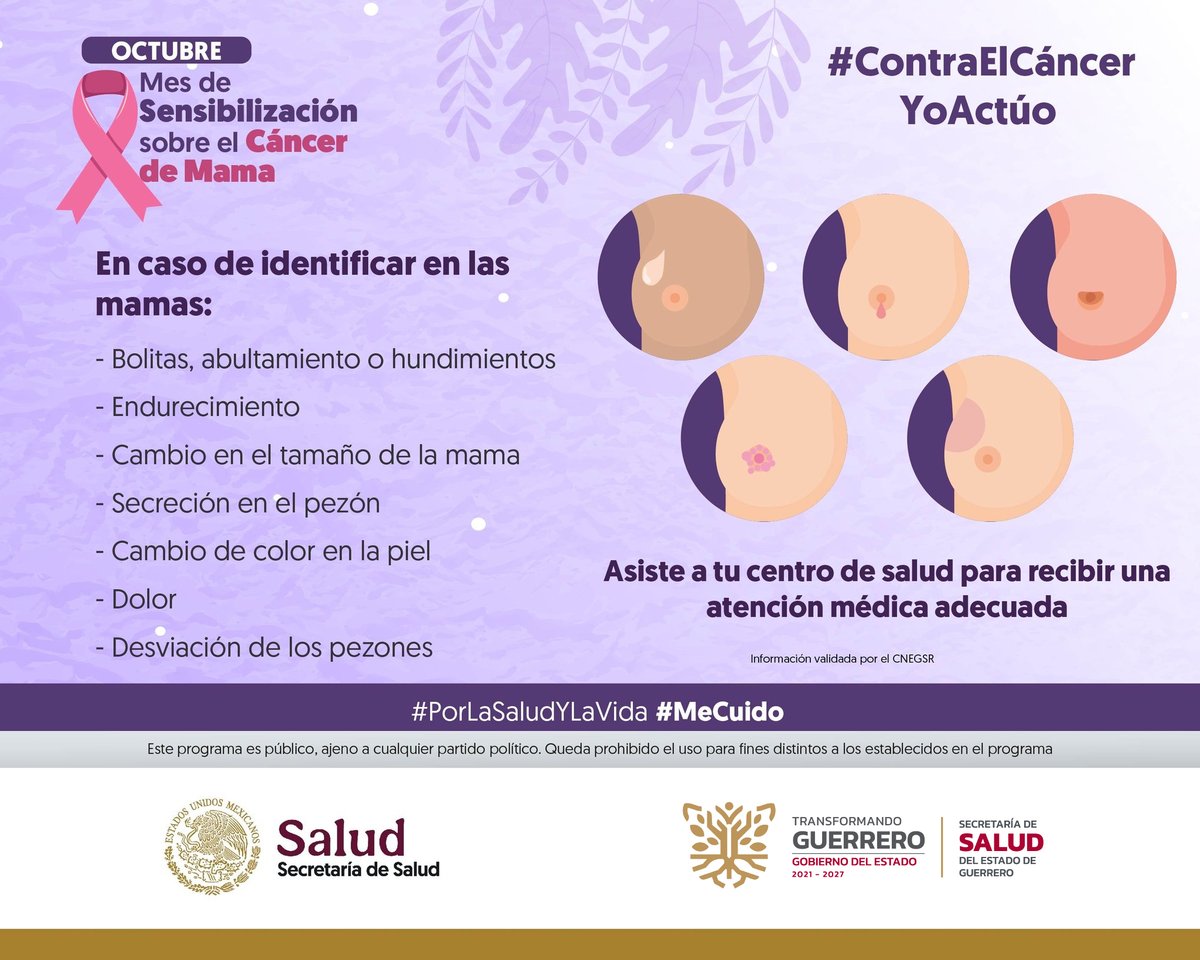PC_Guerrero's tweet image. Octubre I Mes de Sensibilización sobre el #CáncerDeMama 🩺
La autoexploración es una herramienta poderosa para detectar el cáncer de mama de forma oportuna .

Si encuentras alguna alteración, acude a tu Unidad Médica para una valoración 🩺
#Observo  #Toco  #Siento  👁️✋👐