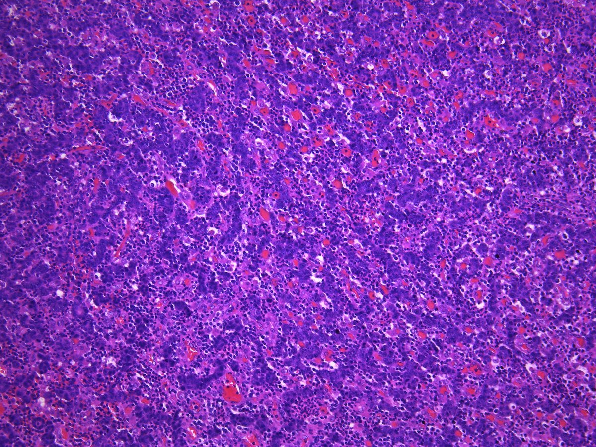 Pathology Walker@Auto Tweet Bot tweet media