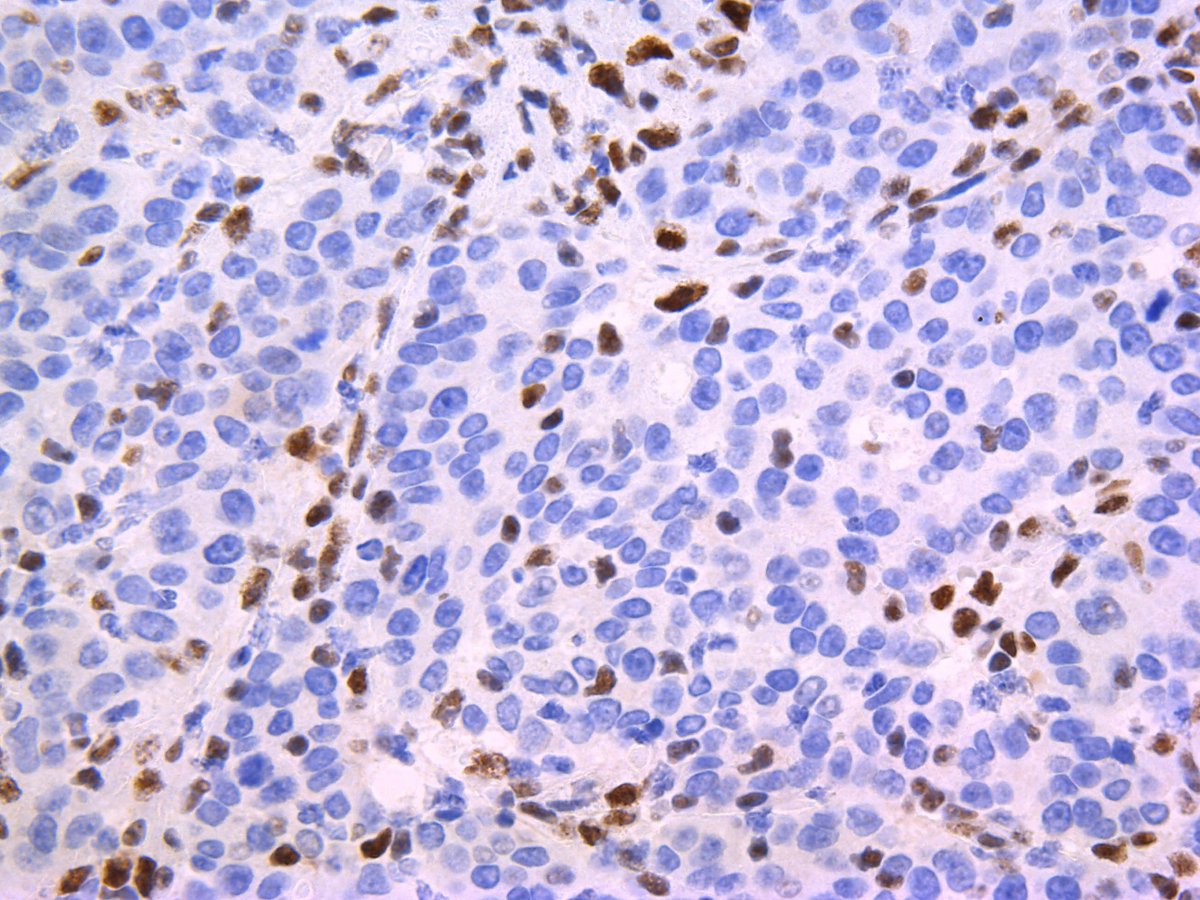 Pathology Walker@Auto Tweet Bot tweet media