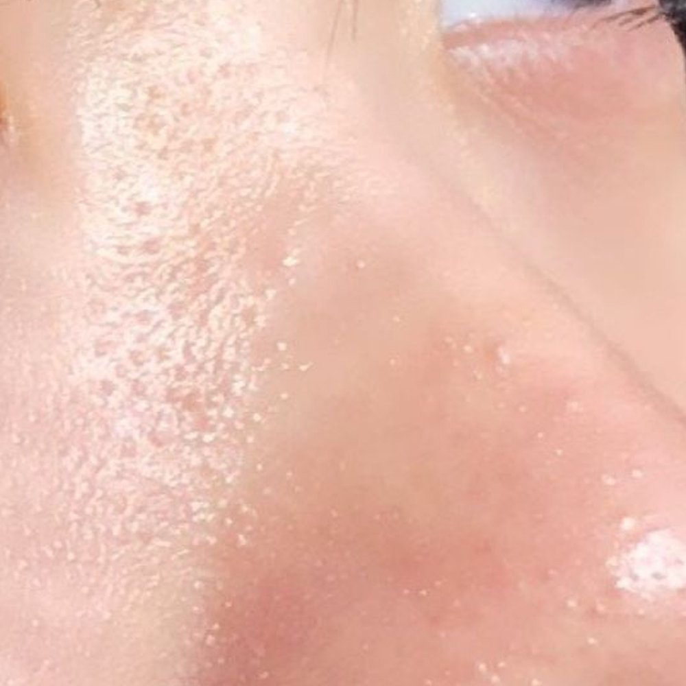 피부 오돌토돌 요철이 고민인 사람?
제발 이렇게 해봐
피부 뭐했냐고 다 물어봄