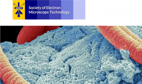 RMS (@royalmicrosoc) on Twitter photo 📢Registration is now open for the December 2024 SEMT <a href="/SocEMTech/">Society of Electron Microscope Technology</a> Meeting <a href="/NHM_London/">Natural History Museum</a>
Find out more and register:
semtuk.org/future-meeting… 📢Registration is now open for the December 2024 SEMT <a href="/SocEMTech/">Society of Electron Microscope Technology</a> Meeting <a href="/NHM_London/">Natural History Museum</a>
Find out more and register:
semtuk.org/future-meeting…