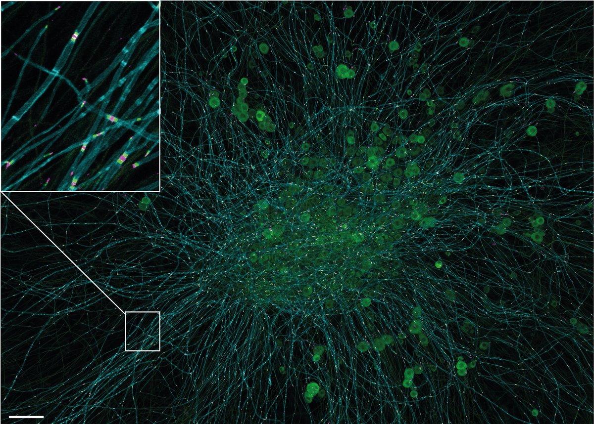 ibidi GmbH (@ibidicells) on Twitter photo #Neural Tapestry🧠
Myelinated #murine dorsal root #ganglion explant, cultivated for 21 days on a µ-Dish 35 mm, high Glass Bottom.
👩🎨 Artwork by Luise Appeltshauser <a href="/LAppeltshauser/">Luise Appeltshauser MD MSc</a> from <a href="/Uniklinikum_Wue/">Universitätsklinikum Würzburg</a>, Germany.
#sciart #cellsinfocus #bioart #technology #imaging #scienceandart #Neural Tapestry🧠
Myelinated #murine dorsal root #ganglion explant, cultivated for 21 days on a µ-Dish 35 mm, high Glass Bottom.
👩🎨 Artwork by Luise Appeltshauser <a href="/LAppeltshauser/">Luise Appeltshauser MD MSc</a> from <a href="/Uniklinikum_Wue/">Universitätsklinikum Würzburg</a>, Germany.
#sciart #cellsinfocus #bioart #technology #imaging #scienceandart