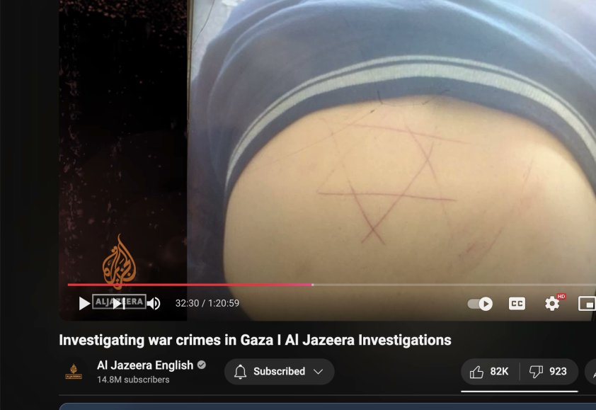 richards1052's tweet image. From @aljazeera Gaza documentary: the stomach of a Palestinian woman on which an IDF soldier scratched a Star of David.  Repulsive. Defiling a Jewish symbol by using it as a tool of torture.  These are not Jews.  They are Judeo-Nazis.