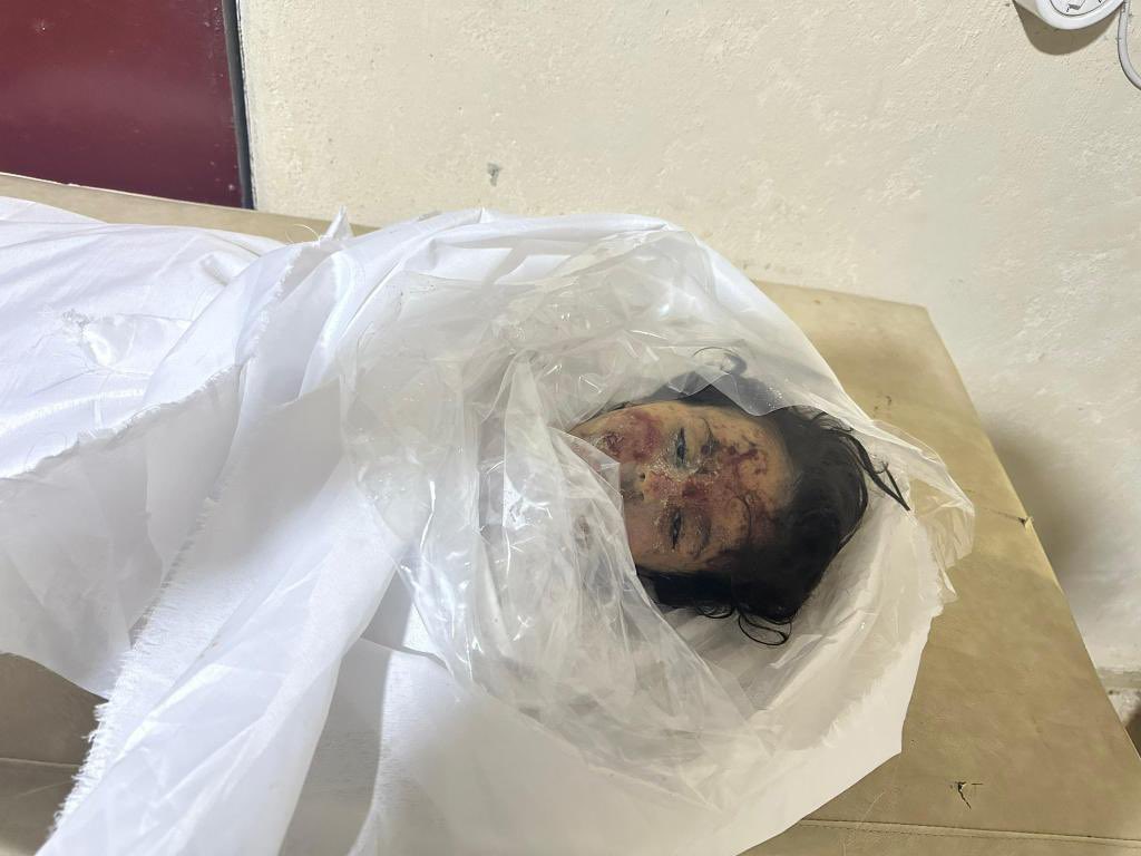 FerhatEncu's tweet photo. Allah sizin belanızı versin! Ne istediniz bu çocuktan? #Rojava https://t.co/BrzeTi3lzP