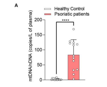 CepidCrid's tweet photo. 🔬 New research reveals how the DNA sensor AIM2 drives psoriasis by triggering type 3 immunity. Important findings from Timna Varela and team,  under supervision of Jose Alves Filho in JCI insight
#Immunology #Psoriasis
https://t.co/7kBJyH28Hl https://t.co/orn78Jiz4l