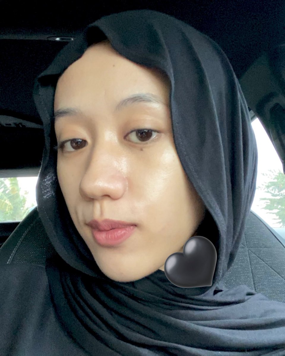 Hasil konsisten nerapin skin cycling selama kurang lebih 2 tahun terakhir. Bekas jerawat hitam hempas bersihh 👍🏻

Step skincare dan jadwalnya aku jelasin semua di bawah 👇🏻