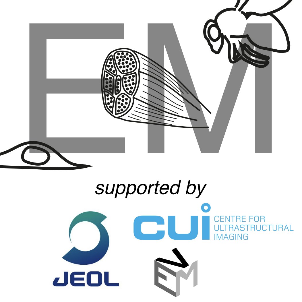 EMofCTO (@emofcto) on Twitter photo Weāve upgraded to a Slack Pro subscription, thanks to funding from <a href="/JEOLEUROPE/">JEOL EUROPE</a>, and support from <a href="/CUIKCL1/">Centre for Ultrastructural Imaging (CUI)</a> and @volumeem1! We can now access our full history and knowledge base. Thanks to our ~1000 members whoāve created such a friendly and stimulating community! Weāve upgraded to a Slack Pro subscription, thanks to funding from <a href="/JEOLEUROPE/">JEOL EUROPE</a>, and support from <a href="/CUIKCL1/">Centre for Ultrastructural Imaging (CUI)</a> and @volumeem1! We can now access our full history and knowledge base. Thanks to our ~1000 members whoāve created such a friendly and stimulating community!