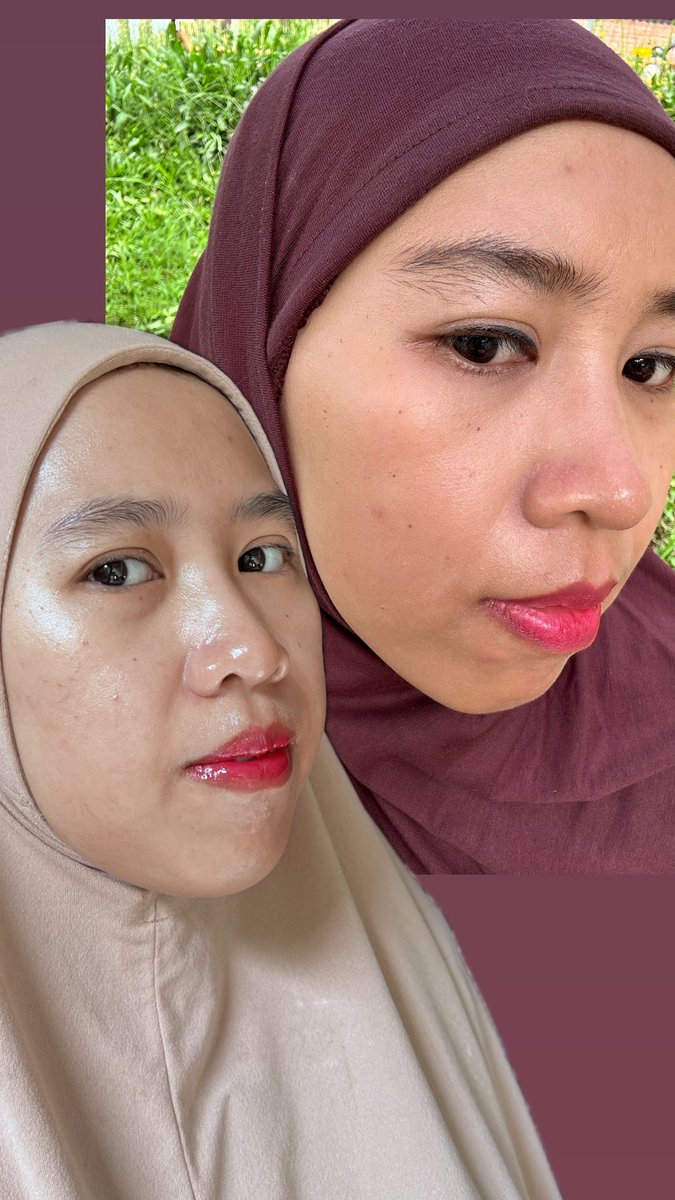 raranolivia's tweet photo. Sejauh Apa skincare mengubah wajahmu? 
Alhamdulillahhhh… 
Ditengah ramainya kasus skincare dengan kandungan yang berbahaya. 
Ibun ketemu skincare yang aman buat kulit. Bahannya Natural juga. Udah Halal Certified dan terdaftar di BPOM.
Sejauh ini kerasa perubahannya di wajah 🥹 https://t.co/Ct2MJPbdyo