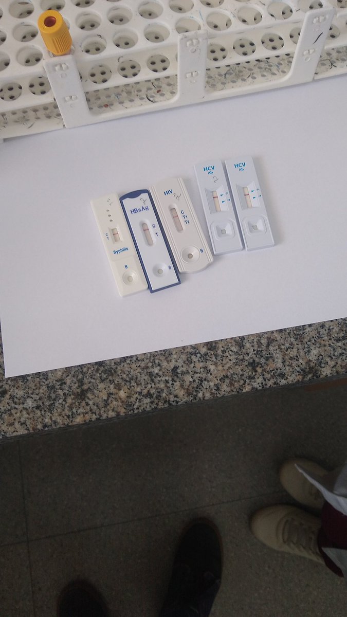 Madinrave's tweet photo. O bom de ser da área de lab é fazer seus próprios exames e testes rápidos.
Ainda fiz minha tipagem sanguínea🔬🧪⚗️🧫 🅰️➕ https://t.co/V8rd0n7NmO
