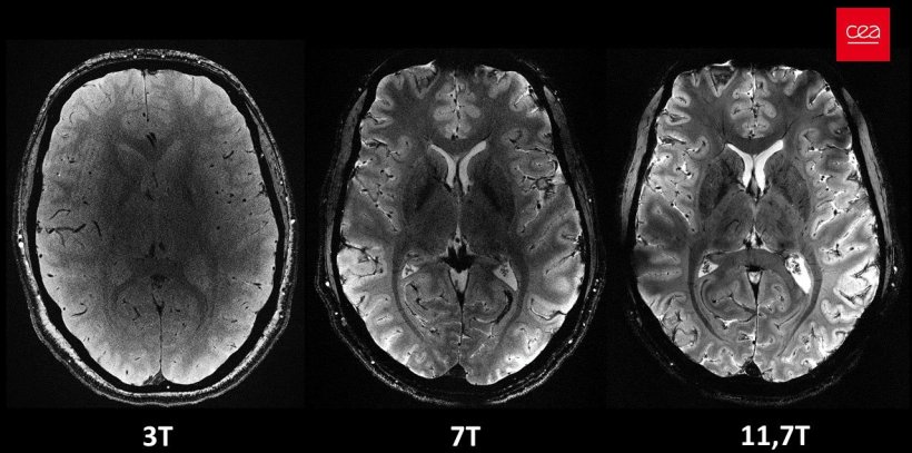 Skope (@skope_mri) on Twitter photo Learn how Skope's field cameras were used in the Iseult 11.7 T project, which was recently highlighted in <a href="/naturemethods/">Nature Methods</a>, detailing the path to obtaining the most precise in vivo images of the human brain. <a href="/aroma_project/">AROMA project</a> #mri #neurosciences #brainimaging
skope.swiss/blog/behind-th… Learn how Skope's field cameras were used in the Iseult 11.7 T project, which was recently highlighted in <a href="/naturemethods/">Nature Methods</a>, detailing the path to obtaining the most precise in vivo images of the human brain. <a href="/aroma_project/">AROMA project</a> #mri #neurosciences #brainimaging
skope.swiss/blog/behind-th…