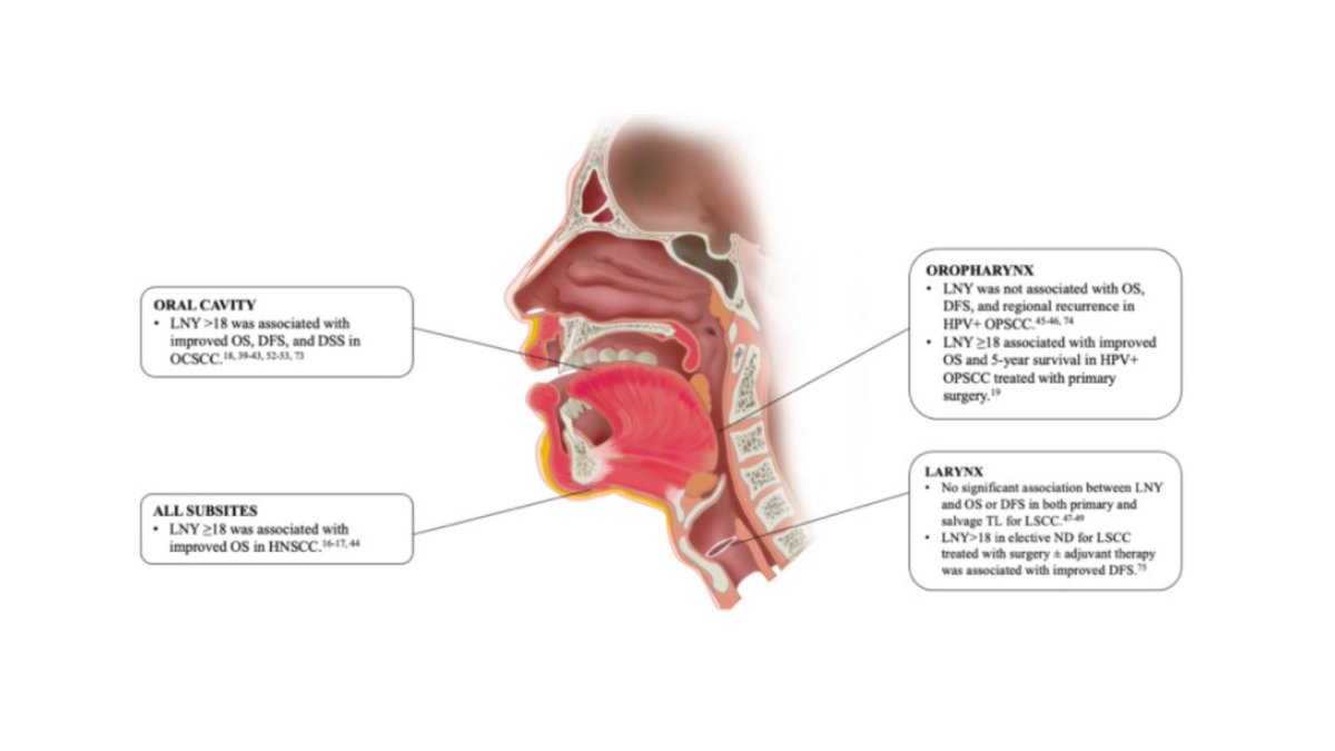 VUMC Otolaryngology–Head and Neck Surgery (@vanderbiltent) on Twitter photo #LymphNodeYield is vital for prognosis in #HeadAndNeckCancer. Our review shows LNY ≥ 18 correlates with better survival, especially in the oral cavity. More research is needed before adopting LNY as a quality metric. <a href="/marina_aweeda/">Marina Aweeda</a> <a href="/KelseyR203/">Kelsey Richard</a> <a href="/TopfHNS/">Michael Topf MD, MSCI</a> sciencedirect.com/science/articl… #LymphNodeYield is vital for prognosis in #HeadAndNeckCancer. Our review shows LNY ≥ 18 correlates with better survival, especially in the oral cavity. More research is needed before adopting LNY as a quality metric. <a href="/marina_aweeda/">Marina Aweeda</a> <a href="/KelseyR203/">Kelsey Richard</a> <a href="/TopfHNS/">Michael Topf MD, MSCI</a> sciencedirect.com/science/articl…