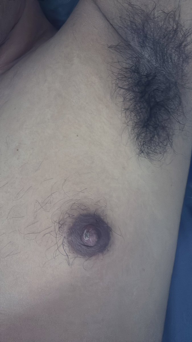 puting_feeder's tweet photo. Minggu kmren puting di gigit sampe luka. Udh mulai kering lukanya https://t.co/LHlQREnnfD