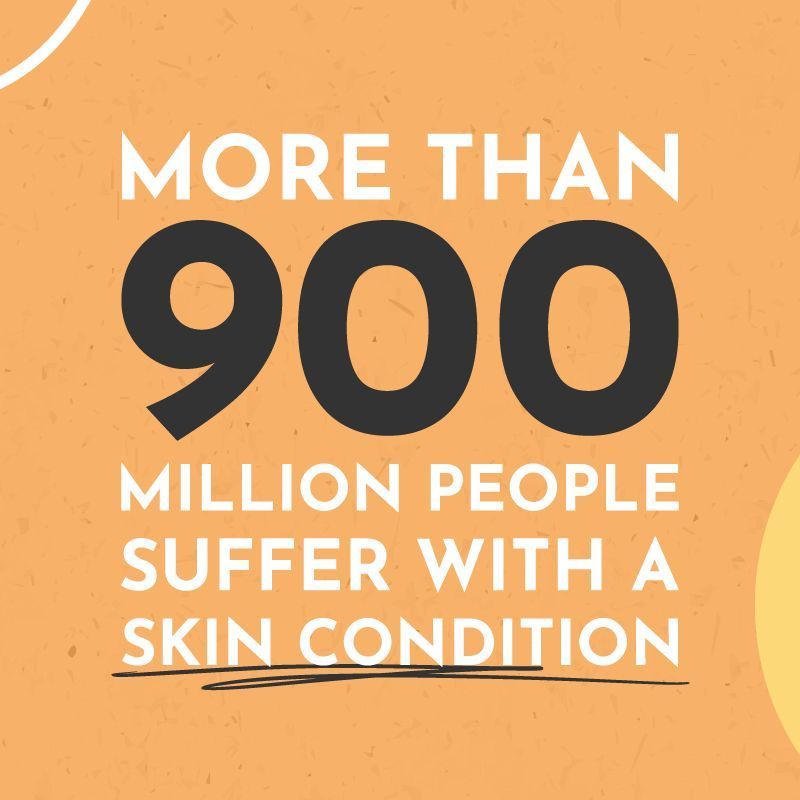 NaturallyTiwa's tweet image. Living with a #SkinCondition? 

You're not alone - over 900 million people are affected! 🌿✨ 

At #NaturallyTiwaSkincare, we empower you to #EmbraceYourSkinsBeauty with our #NaturalProducts

Learn more: buff.ly/3T4CK58