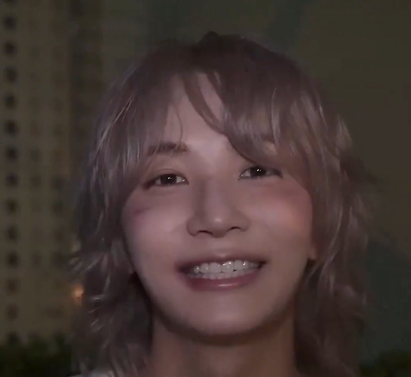 i have never seen anyone who looks beaten up smile with this much teeth in my life