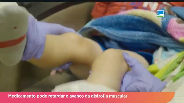 tvcamara's tweet photo. Câmara foi palco de debate sobre o registro do medicamento #Elevidys, usado no tratamento da #distrofia muscular de Duchenne. Segundo a #Anvisa o registro depende de último passo do laboratório responsável pelo remédio no Brasil. https://t.co/RkHzkdwpoq https://t.co/bZqw5O0BJF